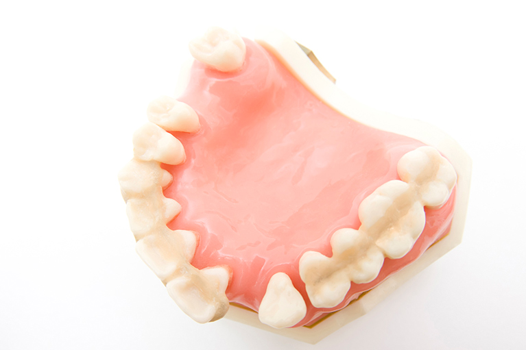 歯周病の症状と進行について